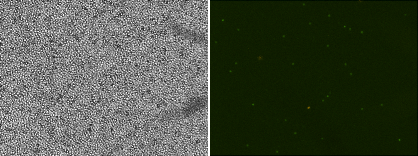 cord blood combined.png cord blood combined.png